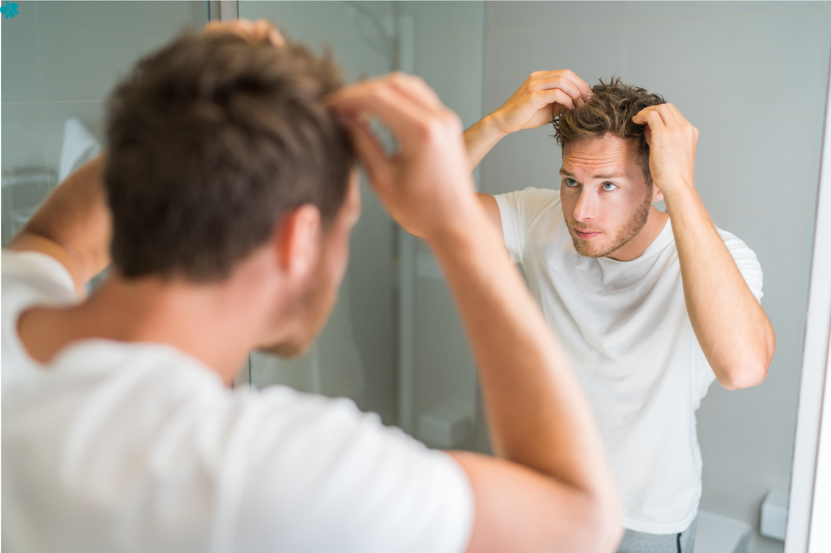 Diferencias entre alopecia androgenética y efluvio telógeno